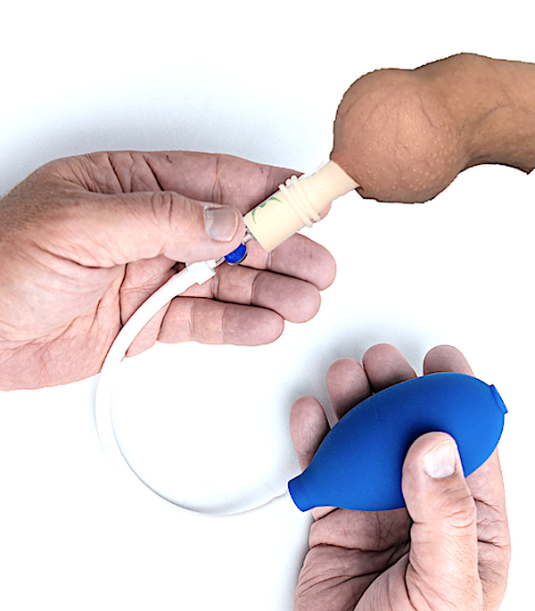 Novoglan Phimosis Treatment - Foreskin Tissue Expander