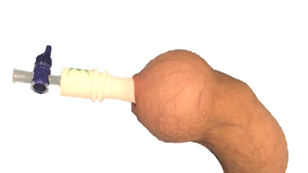 Novoglan Phimosis Treatment - Foreskin Tissue Expander